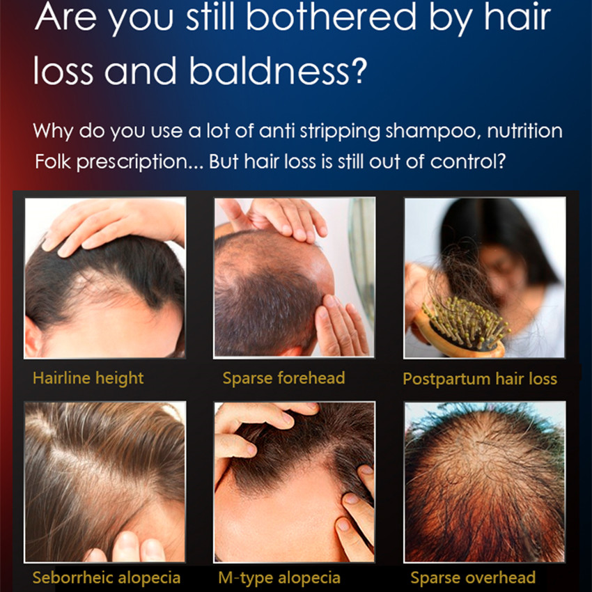 مشط ليزر لنمو الشعر، مشط كهربا - مراجعة Hair Care Brand وسعره